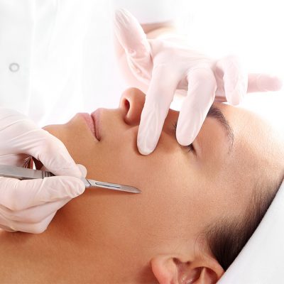 dermaplaning